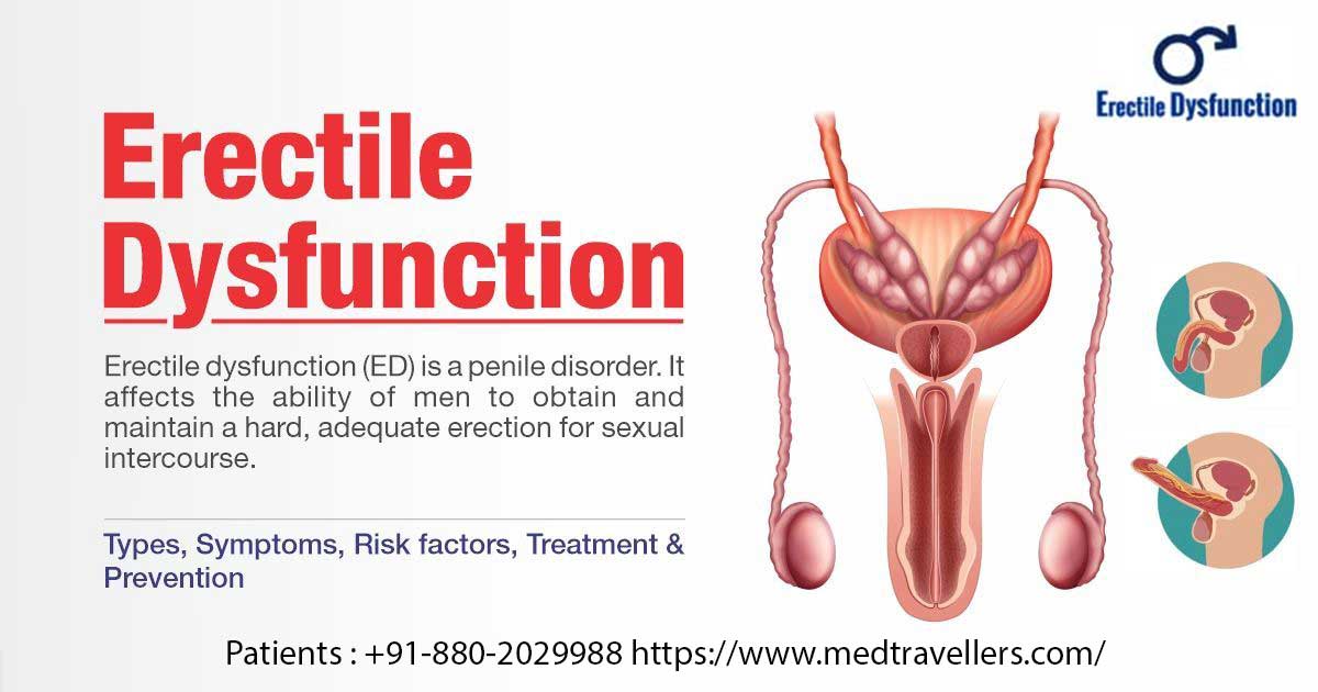 What is the best Treatment for Erectile Dysfunction